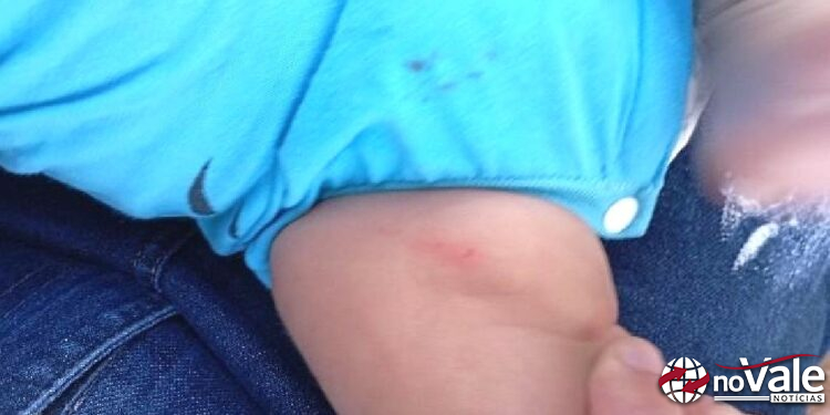 Bebê de 50 dias sofre lesões corporais