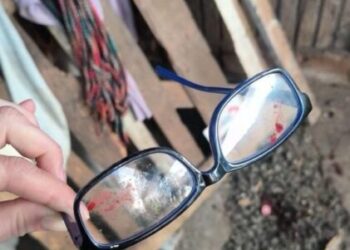 Idoso é gravemente ferido durante roubo em Herval d’Oeste
