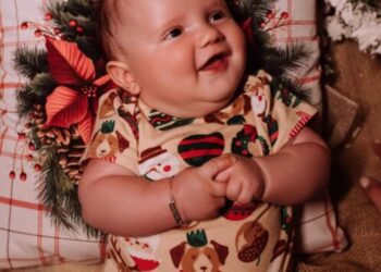 Confirmada para esta quinta (29) cirurgia do bebê de Capinzal diagnosticado com fechamento precoce da moleira