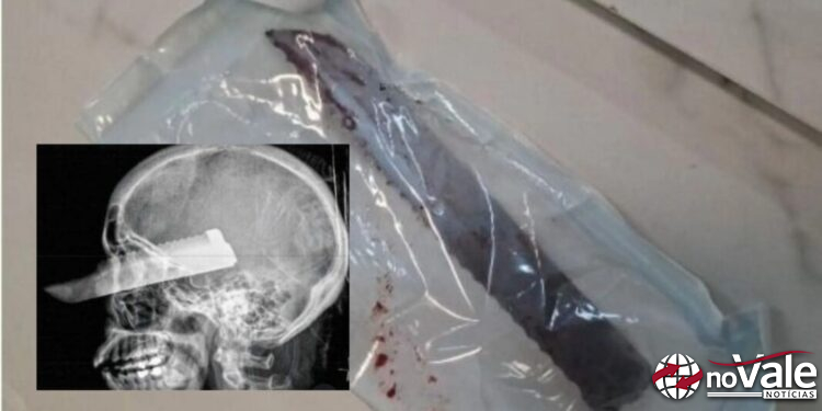 “Ficou cega” marido cheira cocaína e crava faca no rosto da esposa em Santa Catarina