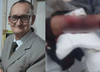 Brutal: Trabalhador fica gravemente ferido após ataque de pitbull