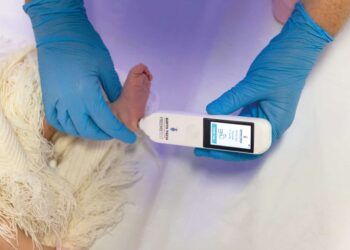 SUS vai usar tecnologia brasileira que analisa pele do pé de bebês para avaliar prematuridade