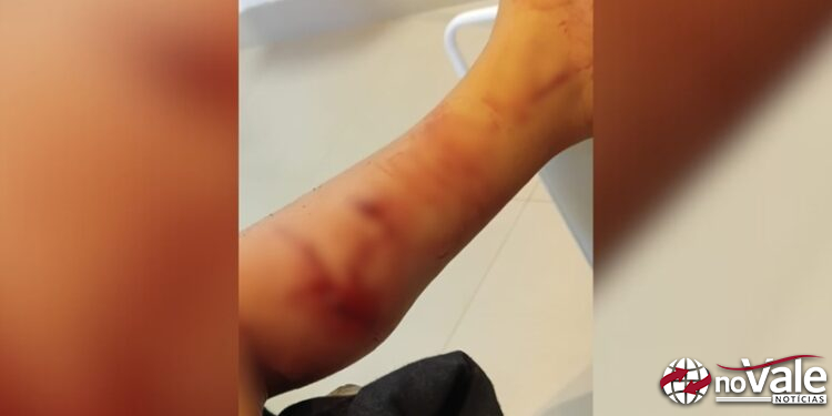 Criança de 3 anos é atacada por cachorro próximo a creche em Ponte Serrada